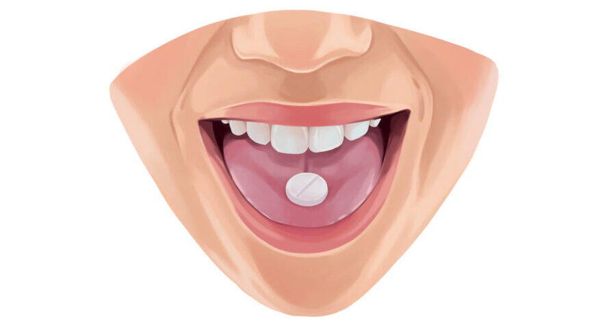 Drawing of a patient with oral sedation pill on their tongue
